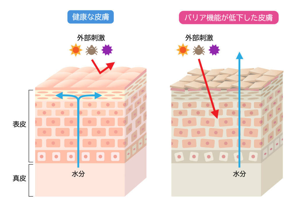 健康な肌とバリア機能が低下した肌のイメージ